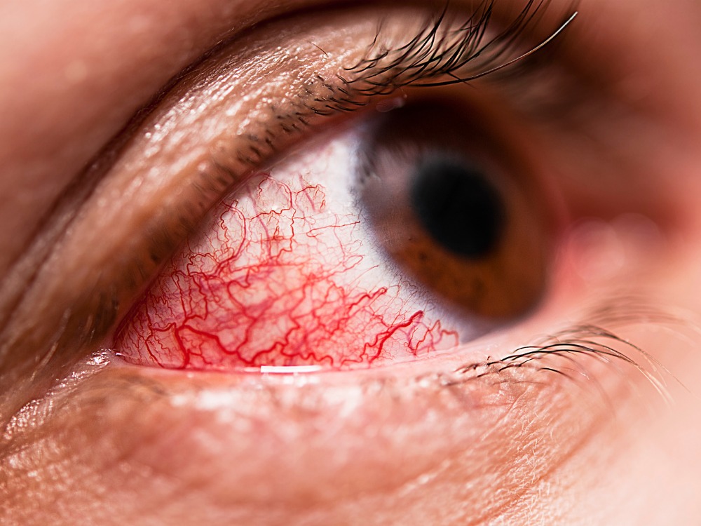 Quais as principais doenças dos olhos?