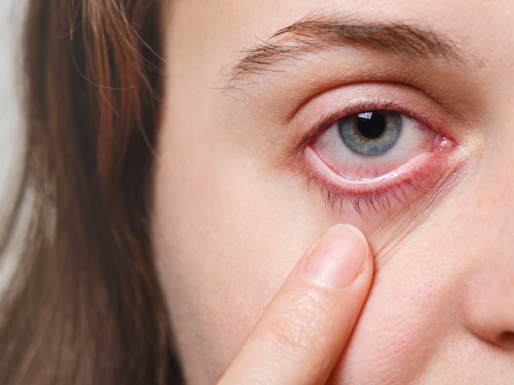 O que provoca inflamação nos olhos?
