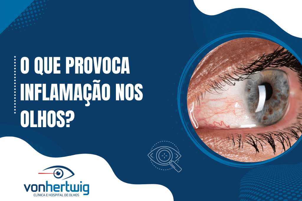 O que provoca Inflamação nos Olhos?