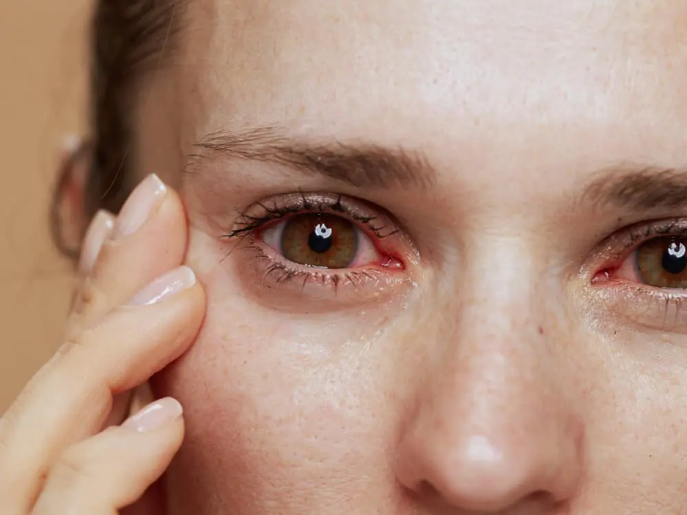 Derrame ocular pode ser sinal de AVC?