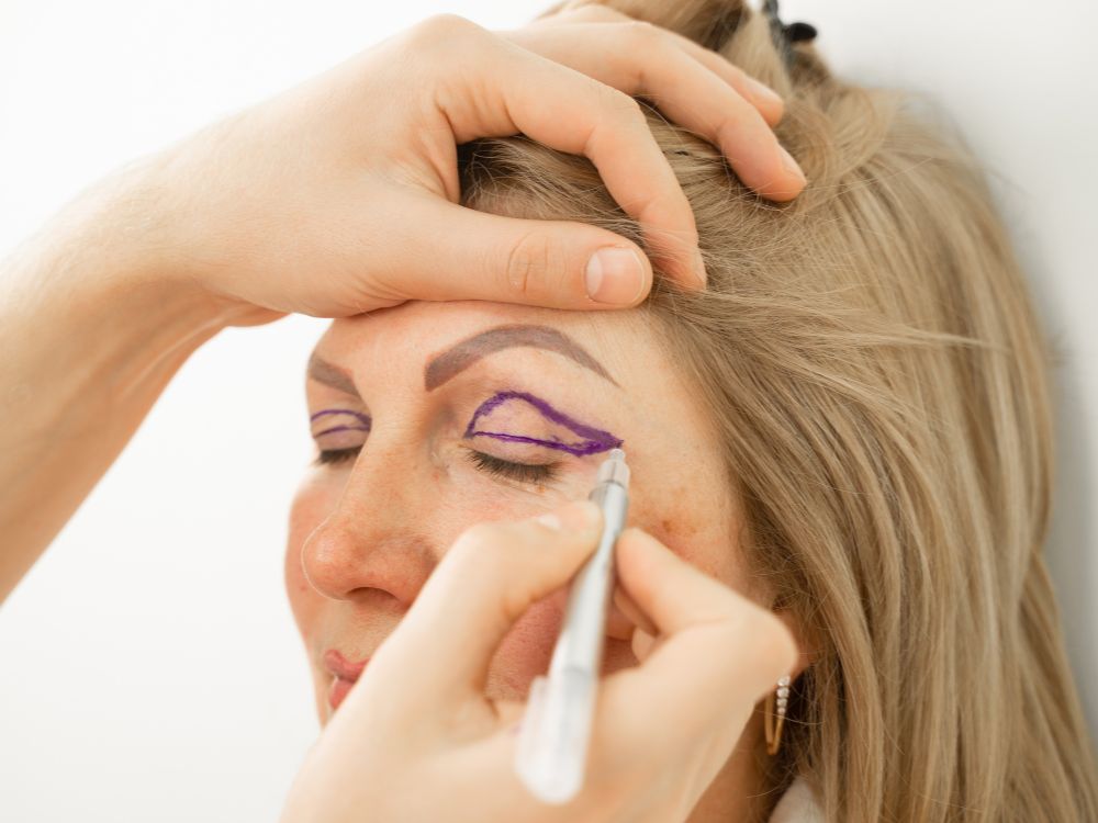 O que é a plástica nos olhos?
