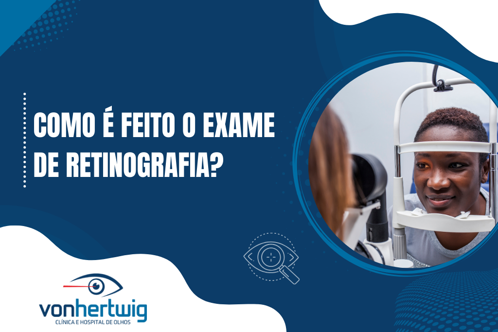 Como é feito o exame de retinografia?