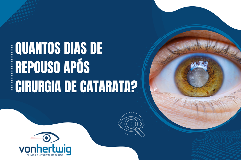 Quantos dias de repouso após cirurgia de catarata?