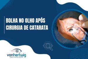 Banner informativo com o texto 'Bolha no olho após cirurgia de catarata' ao lado de uma imagem de procedimento ocular, representando possíveis complicações pós-operatórias