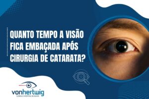 Banner informativo com foco em recuperação ocular e a pergunta "Quanto tempo a visão fica embaçada após cirurgia de catarata?" com destaque em exame oftalmológico.