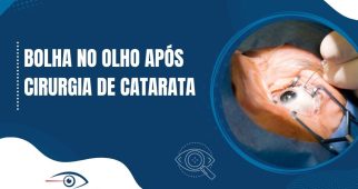Banner informativo com o texto 'Bolha no olho após cirurgia de catarata' ao lado de uma imagem de procedimento ocular, representando possíveis complicações pós-operatórias