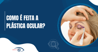 Como é feita a plástica ocular