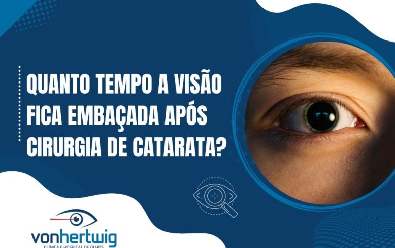 Banner informativo com foco em recuperação ocular e a pergunta "Quanto tempo a visão fica embaçada após cirurgia de catarata?" com destaque em exame oftalmológico.