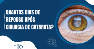 quantos dias de repouso após cirurgia de catarata